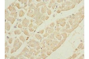 Immunohistochemistry of paraffin-embedded human heart tissue using ABIN7163881 at dilution of 1:100 (GALNT2 antibody  (AA 442-571))