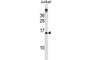 Western blot analysis in Jurkat cell line lysates (35ug/lane) using PLAC4  Antibody . (PLAC4 antibody  (N-Term))