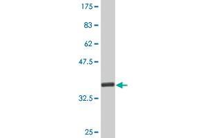 Western Blot detection against Immunogen (35. (CDK4 antibody  (AA 211-303))