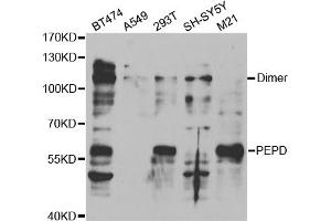 Western blot analysis of extracts of various cell lines, using PEPD antibody (ABIN5973143) at 1/1000 dilution. (PEPD antibody)
