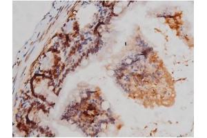 ABIN6267362 at 1/200 staining Mouse intestinal tissue sections by IHC-P. (MAPT antibody  (pThr205))