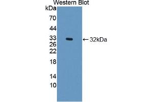 Western blot analysis of the recombinant protein. (DOCK2 antibody  (AA 390-635))