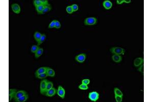 TINAGL1 antibody  (AA 250-467)