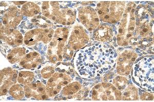 Human kidney (PTGDS antibody  (N-Term))