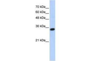 Image no. 1 for anti-Complement C1q Tumor Necrosis Factor-Related Protein 4 (C1QTNF4) (AA 107-156) antibody (ABIN6743640) (C1QTNF4 antibody  (AA 107-156))