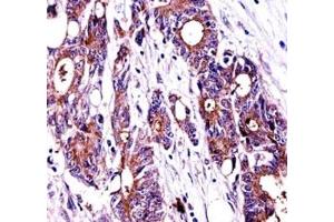 Immunohistochemistry (IHC) image for anti-Nucleophosmin (Nucleolar phosphoprotein B23, Numatrin) (NPM1) (AA 198-226) antibody (ABIN3032076)