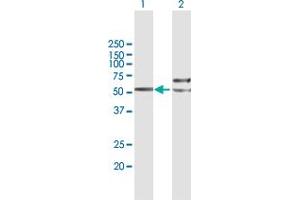 Western Blot analysis of TUBB4Q expression in transfected 293T cell line by TUBB4Q MaxPab polyclonal antibody. (TUBB7P antibody  (AA 1-434))