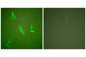 Immunofluorescence analysis of HeLa cells, using Caspase 10 antibody. (Caspase 10 antibody  (C-Term))