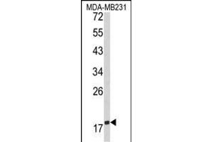 Western blot analysis of CD28 Antibody (C-term) (ABIN390970 and ABIN2841150) in MDA-M cell line lysates (35 μg/lane). (CD28 antibody  (C-Term))