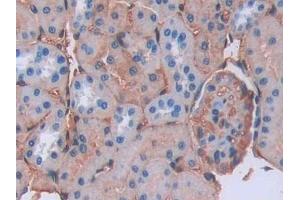 Detection of LCNL1 in Rat Kidney Tissue using Polyclonal Antibody to Lipocalin Like Protein 1 (LCNL1) (LCNL1 antibody)