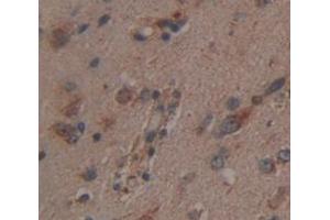 Figure. (CNDP1 antibody  (AA 332-507))