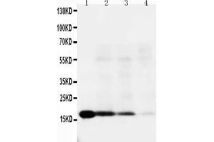 Lane 4: RAJI Cell Lysate (IL-18 antibody  (C-Term))