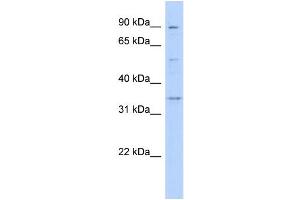 WB Suggested Anti-WNT9B Antibody Titration:  0.