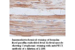 Image no. 1 for anti-Enoyl-CoA Delta Isomerase 2 (PECI) antibody (ABIN791176) (PECI/ECI2 antibody)