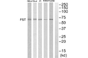 Western blot analysis of extracts from HepG2, K562, COLO205, Jurkat and HeLa cells, using FST antibody. (Follistatin antibody)