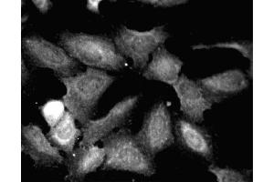 Immunofluorescent staining of HeLa (ATCC CCL-2) cells. (Paxillin antibody  (AA 1-557))