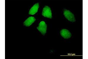 Immunofluorescence of purified MaxPab antibody to HIRA on HeLa cell. (HIRA antibody  (AA 1-1017))