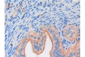 Detection of FGF6 in Mouse Ovary Tissue using Polyclonal Antibody to Fibroblast Growth Factor 6 (FGF6) (FGF6 antibody  (AA 39-208))
