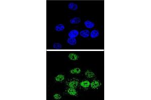 Confocal immunofluorescent analysis of MEF2A Antibody (Center) (ABIN653206 and ABIN2842748) with Hela cell followed by Alexa Fluor® 488-conjugated goat anti-rabbit lgG (green).