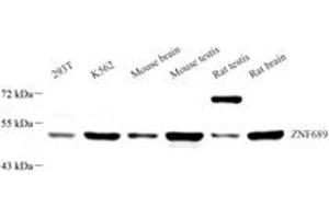 Western blot analysis of ZNF689 (ABIN7076271) at dilution of 1: 1500 (ZNF689 antibody)