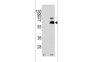 Western blot analysis of RPS6KB1 using rabbit polyclonal RPS6KB1 Antibody (S404) using 293 cell lysates (2 ug/lane) either nontransfected (Lane 1) or transiently transfected with the RPS6KB1 gene (Lane 2). (RPS6KB1 antibody  (AA 405-434))