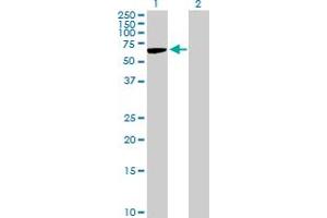 Western Blot analysis of TPBG expression in transfected 293T cell line by TPBG MaxPab polyclonal antibody. (TPBG antibody  (AA 1-420))