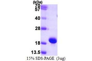 SDS-PAGE (SDS) image for Small Ubiquitin Related Modifier Protein 1 (SUMO1) (AA 1-101) protein (His tag) (ABIN667608)