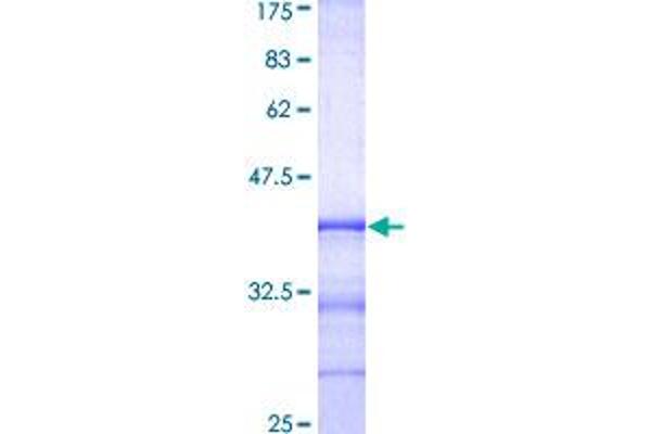 RAB8A Protein (AA 108-207) (GST tag)