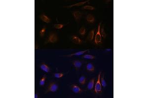 Immunofluorescence analysis of U-2 OS cells using VMP1 Polyclonal Antibody (ABIN7271283) at dilution of 1:100 (40x lens). (VMP1 antibody  (C-Term))
