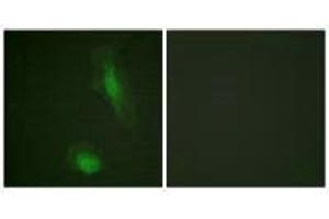 Immunofluorescence analysis of HeLa cells, using Akt (Ab-129) antibody. (AKT1 antibody  (Ser129))