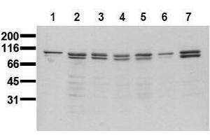 Western Blotting (WB) image for anti-FER Tyrosine Kinase (FER) antibody (ABIN126799) (FER antibody)