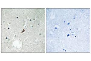 Immunohistochemistry analysis of paraffin-embedded human brain tissue using PYK2 (Phospho-Tyr579) antibody. (PTK2B antibody  (pTyr579))