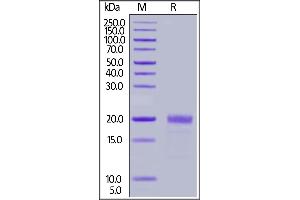 Biotinylated Human MIF, His,Avitag on  under reducing (R) condition.