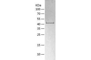 ACADL Protein (AA 31-430) (His tag)