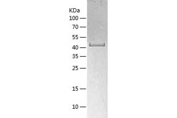 ACADL Protein (AA 31-430) (His tag)