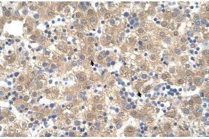Human Liver (PPIB antibody  (C-Term))