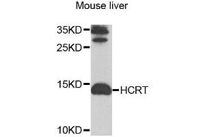 Western blot analysis of extracts of mouse liver, using HCRT antibody (ABIN6003553) at 1/1000 dilution. (Orexin antibody)
