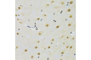 Immunohistochemistry of paraffin-embedded rat brain using DDB1 Antibody. (DDB1 antibody)