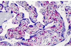 Human Placenta: Formalin-Fixed, Paraffin-Embedded (FFPE) (IKBKG antibody)