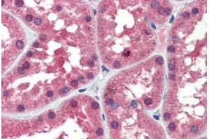 Human Kidney (formalin-fixed, paraffin-embedded) stained with IDH1 antibody ABIN462259 followed by biotinylated goat anti-rabbit IgG secondary antibody ABIN481713, alkaline phosphatase-streptavidin and chromogen. (IDH1 antibody  (AA 290-339))
