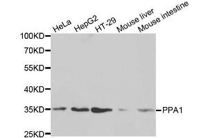 Western blot analysis of extracts of various cell lines, using PPA1 antibody. (Pyrophosphatase (Inorganic) 1 (PPA1) (AA 1-289) antibody)