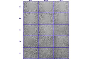 Cell Migration Time Course. (Radius™ 24-Well Cell Migration Assay)