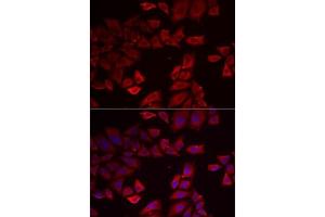 Immunofluorescence analysis of MCF7 cells using SEPHS1 antibody . (SEPHS1 antibody  (AA 1-392))