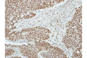 Image no. 1 for anti-Zinc Finger and BTB Domain Containing 9 (ZBTB9) (AA 1-206) antibody (ABIN1501798) (ZBTB9 antibody  (AA 1-206))