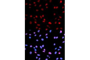 Immunofluorescence analysis of U2OS cells using Phospho-RB-S795 antibody (ABIN5969932). (Retinoblastoma 1 antibody  (pSer795))