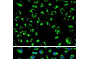 Immunofluorescence analysis of MCF-7 cells using PPP4C Polyclonal Antibody (PPP4C antibody)
