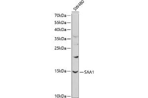 Western blot analysis of extracts of SW480 cells, using S antibody (ABIN3022330, ABIN3022331, ABIN3022332 and ABIN6218744) at 1:1000 dilution.