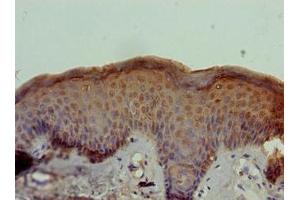 Immunohistochemistry of paraffin-embedded human skin tissue using ABIN7170811 at dilution of 1:100 (STOX1 antibody  (AA 559-858))