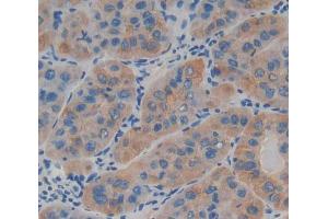 IHC-P analysis of Kidney tissue, with DAB staining. (LAMb4 antibody  (AA 1543-1759))