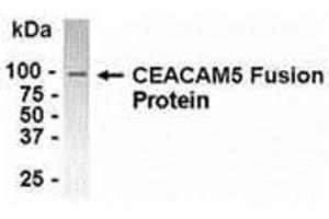 Western Blotting (WB) image for anti-Carcinoembryonic Antigen-Related Cell Adhesion Molecule 5 (CEACAM5) (AA 460-600) antibody (ABIN2468129) (CEACAM5 antibody  (AA 460-600))